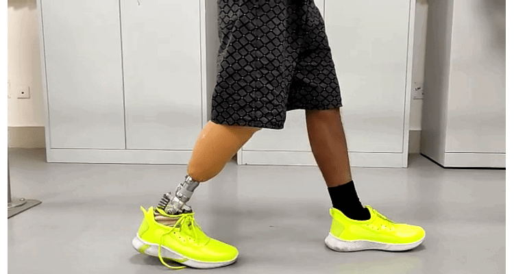 IIT Guwahati designs sustainable cost-effective prosthetic legs adjustable for the different age groups
