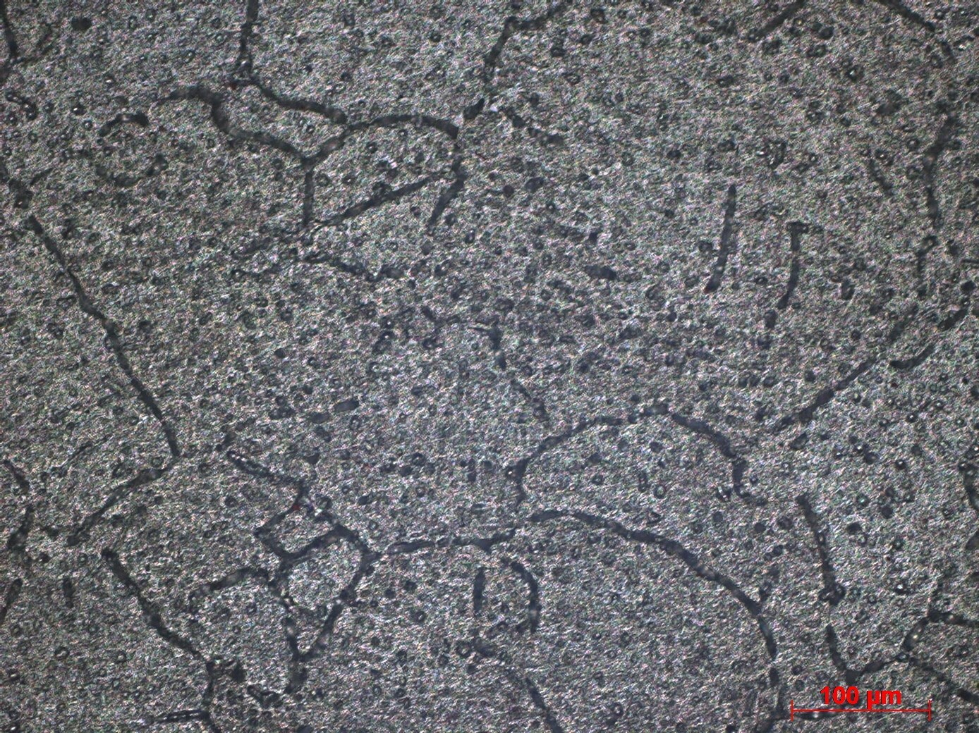 Aluminium alloy microstructure